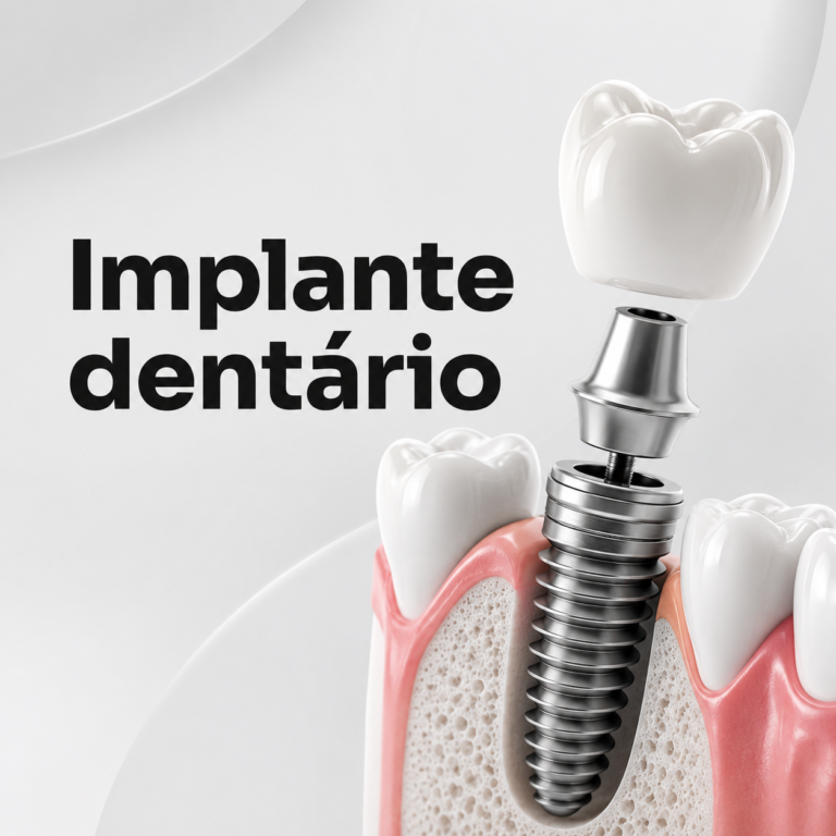 Implante Dentário