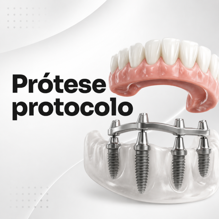 Prótese Protocolo